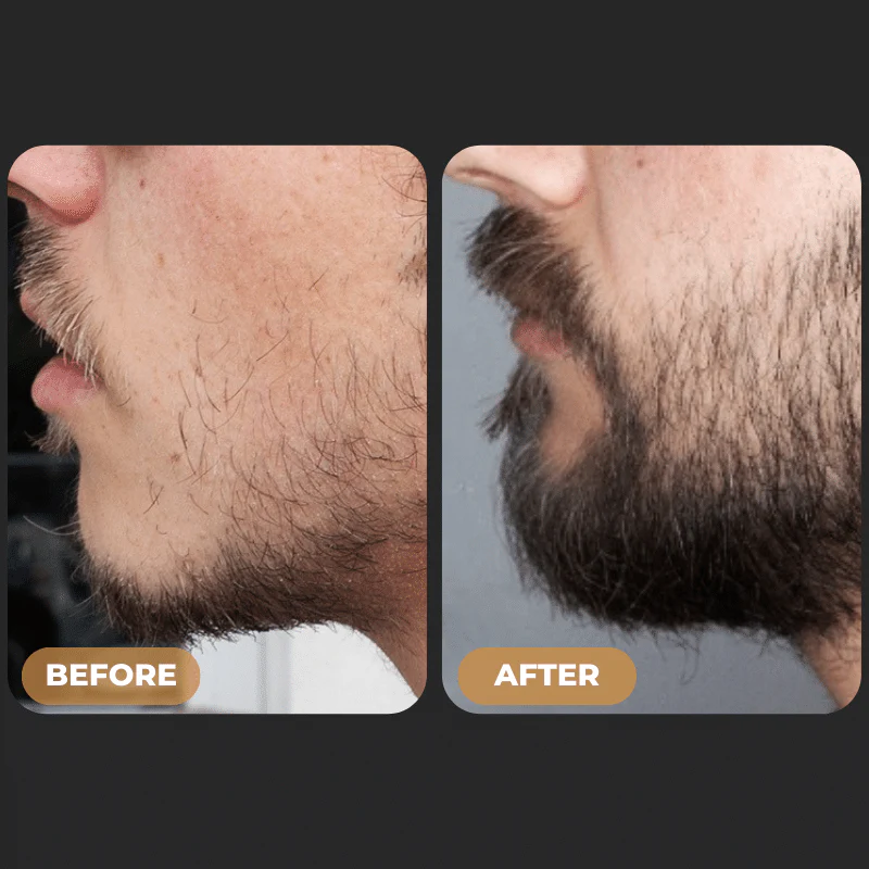 SPARTAN™ - Beard Growth Oil - Image 5