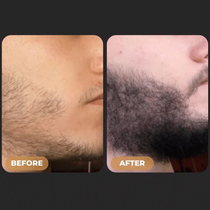 SPARTAN™ - Root Activator Spray & Beard Growth Bundle - Image 3