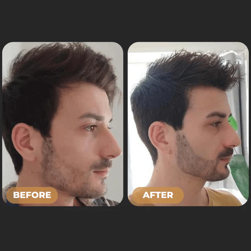 SPARTAN™ - Root Activator Spray & Beard Growth Bundle - Image 4