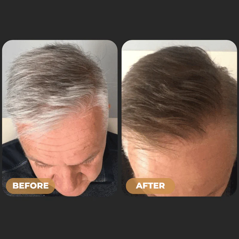 SPARTAN™ - Instant Hair Dye Shampoo - Image 7