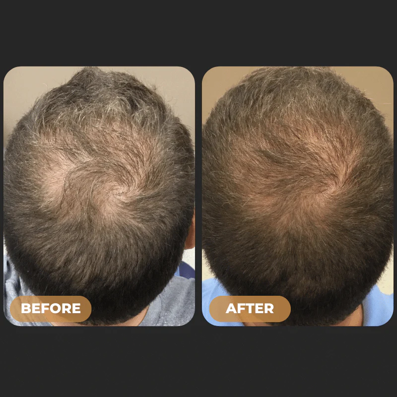 SPARTAN™ - Root Activator Shampoo - Image 5