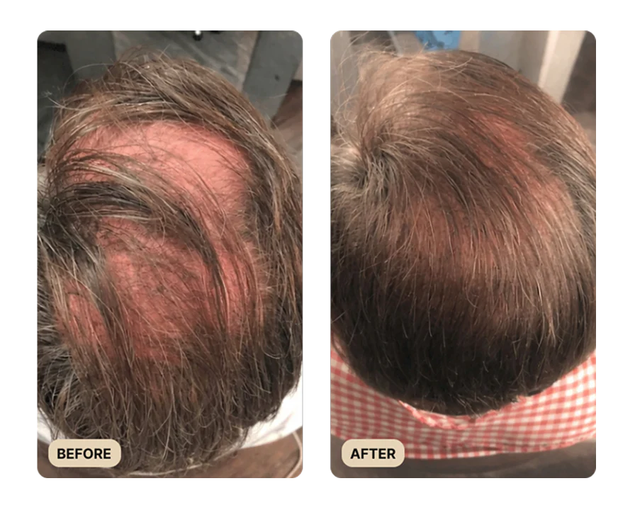 Root Activator Shampoo (TEST) - Image 4