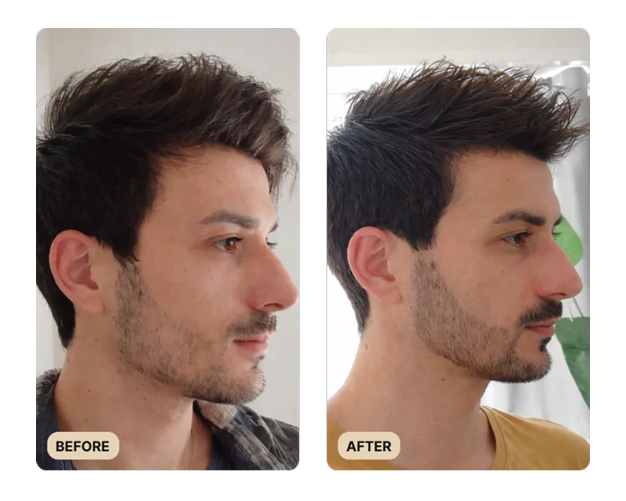 Beard Growth Kit (TEST) - Image 4