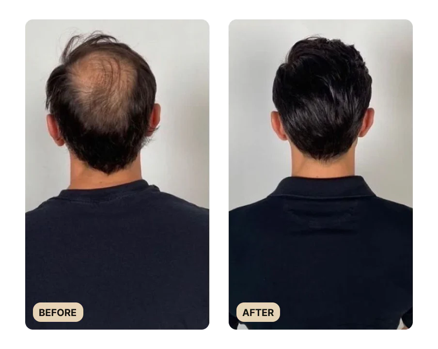 Full Hair Growth System (TEST) - Image 4