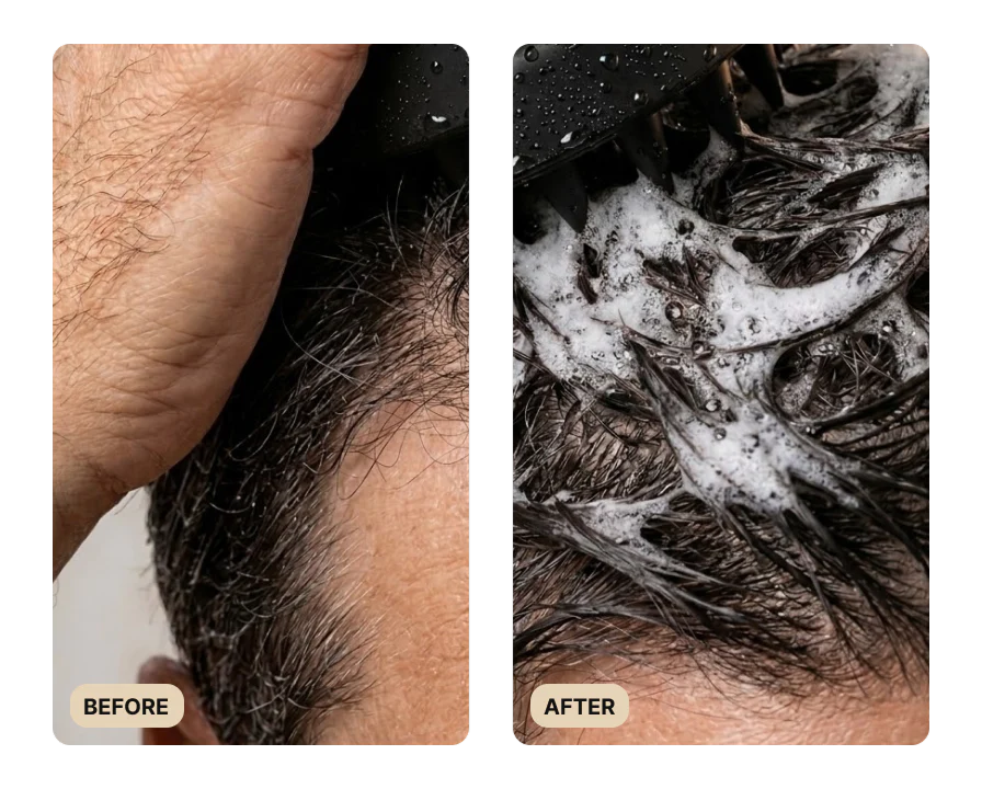 Full Hair Growth System (TEST) - Image 6
