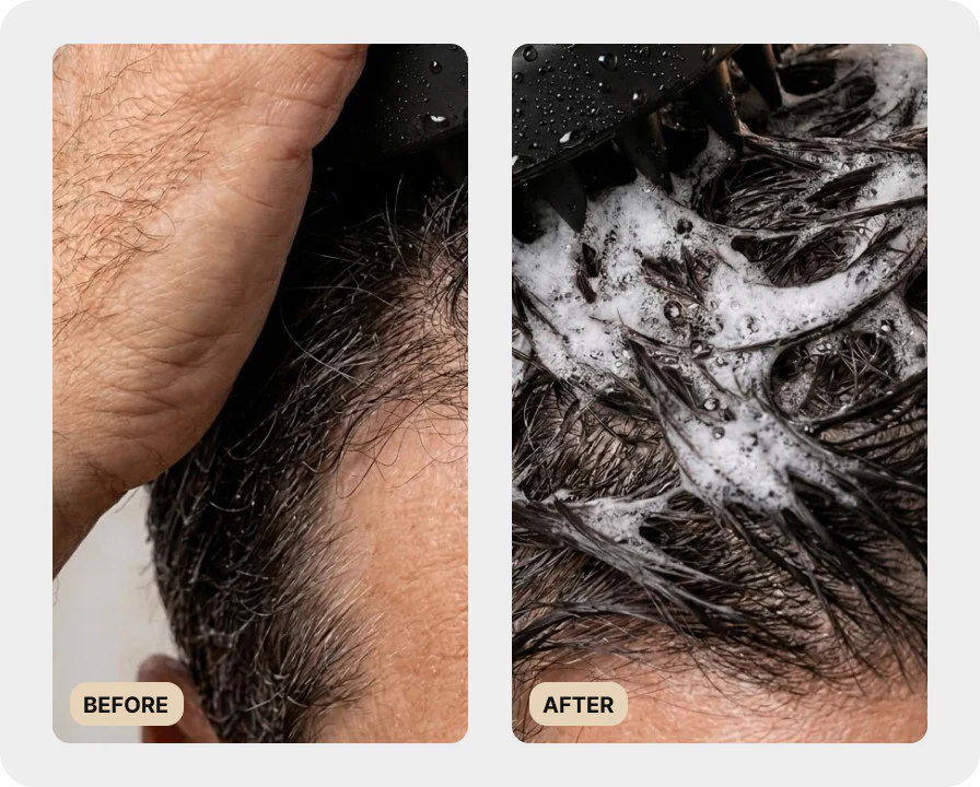 Premium Scalp Brush (TEST) - Image 2
