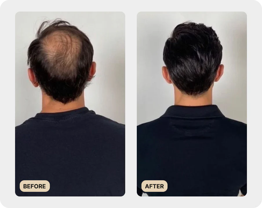 Premium Scalp Brush (TEST) - Image 4