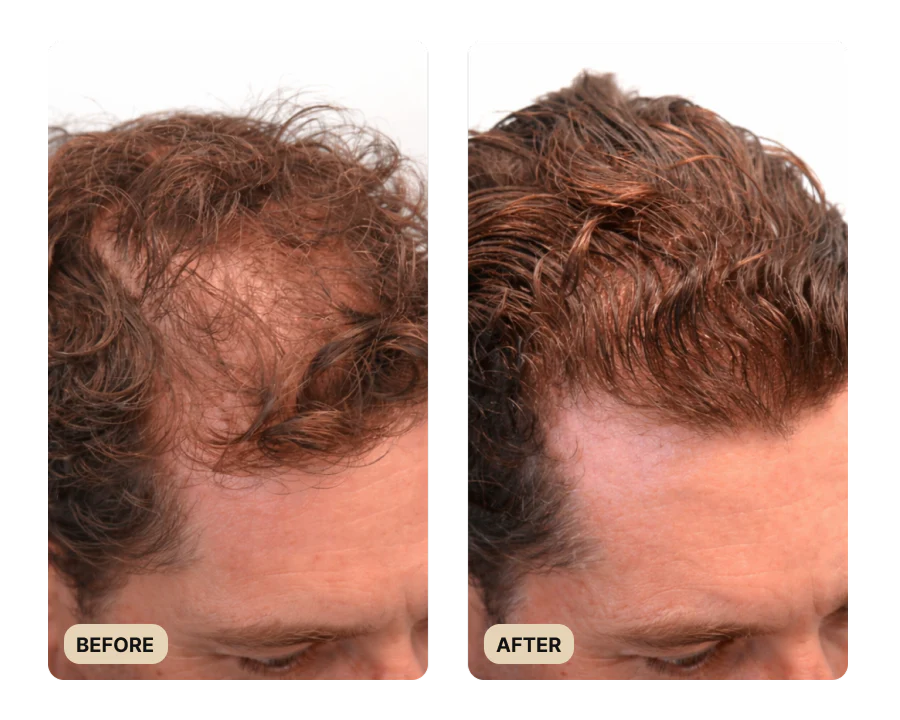 Root Activator Conditioner (TEST) - Image 4