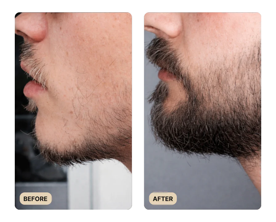 Root Activator Spray & Beard Growth Bundle (TEST) - Image 4
