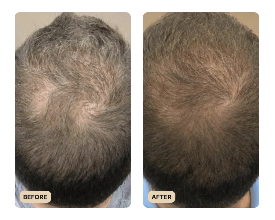 Root Activator Spray (TEST) - Image 2