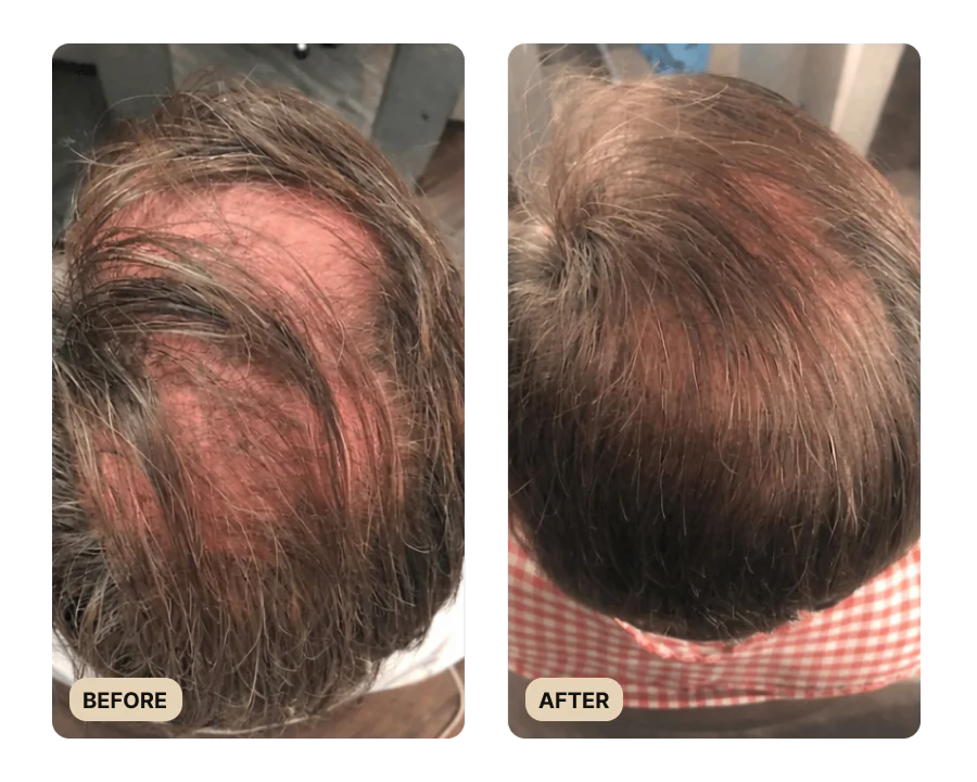 Root Activator Spray (TEST) - Image 4